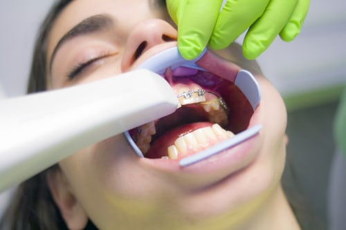 4 Problems Cosmetic Dentist Can Solve